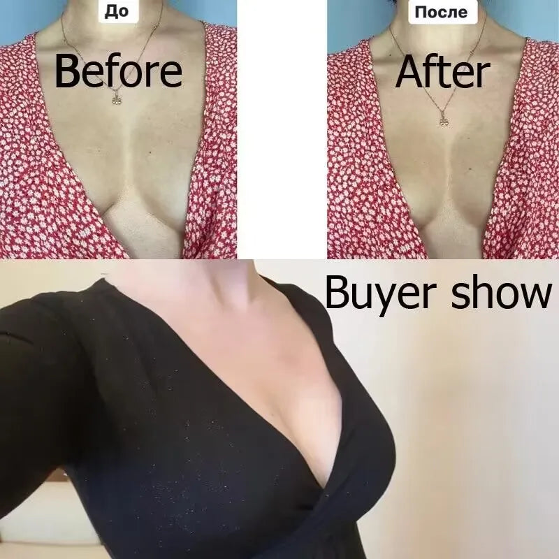 Invisible Push-Up Bra 5-Pairs Set - Self-Adhesive Backless Strapless Silicone Nipple Covers