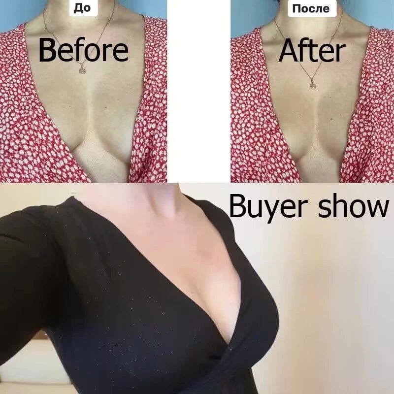 Invisible Push-Up Bra 5-Pairs Set - Self-Adhesive Backless Strapless Silicone Nipple Covers